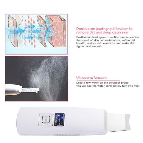 Ultrasonic Blackhead Acne Removal