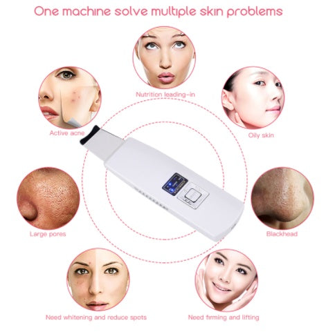 Ultrasonic Blackhead Acne Removal
