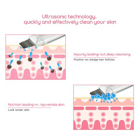 Ultrasonic Blackhead Acne Removal